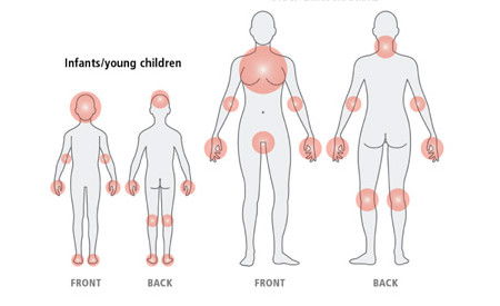 Red spots on skin due to stress